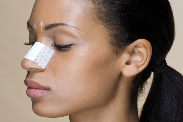 rhinoplasty