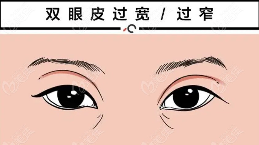 eye plastic surgeries eye plastic surgeries