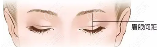 Double Eyelid Surgery Double Eyelid Surgery