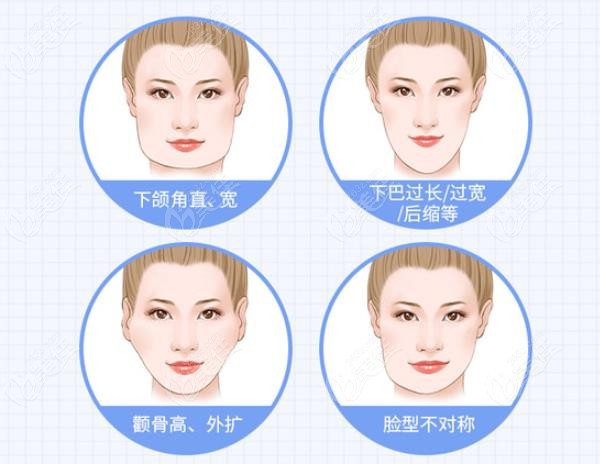 What about Dr. Lin Zongyu's Cheekbone Reduction Technique ? What about Dr. Lin Zongyu's Cheekbone Reduction Technique ?
