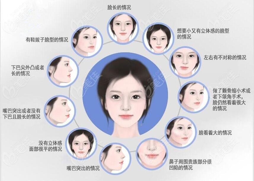 double jaw surgery double jaw surgery