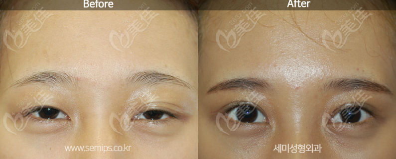 a unique eye design standard a unique eye design standard