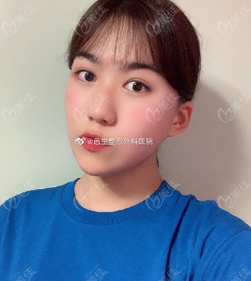he patient's chin was relatively small he patient's chin was relatively small