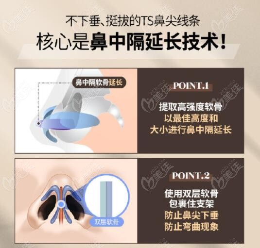 Nose reshaping Nose reshaping
