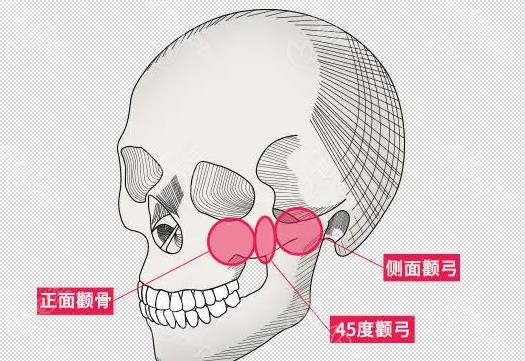FHow is Cooki Plastic Surgery's Facial Contouring? Zheng Chengmo's Three-piece Done Well, with a Natural Style